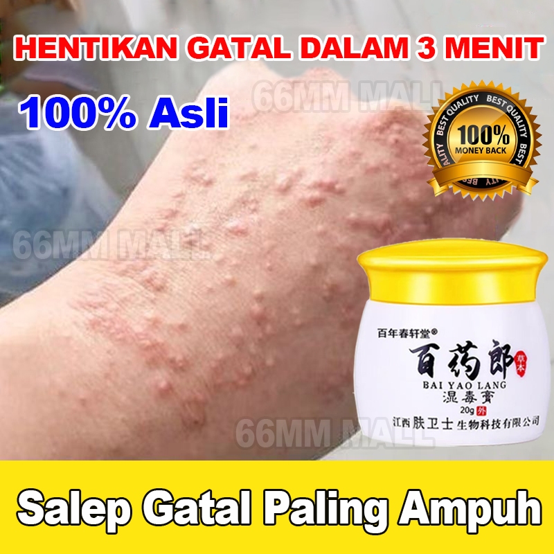 Salep Eksim Kering dan Gatal Salep Gatal China Paling Ampuh Obat Gatal Selangkangan Salep Bayi Untuk