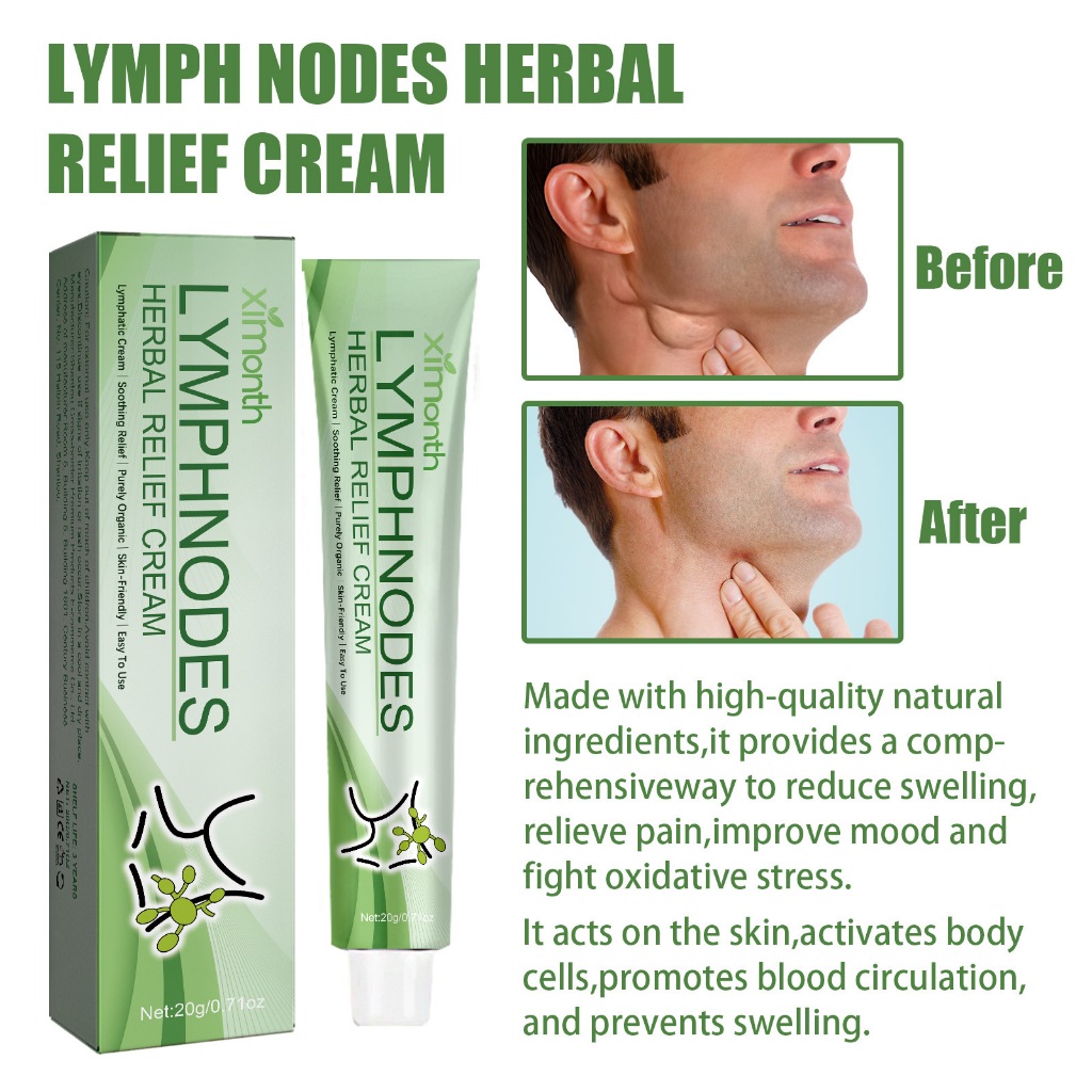 Ximonth Krim Perbaikan Limfatik Herbal 20g Lymph Nodes Herbal Relief Cream Menghilangkan Pembengkaka