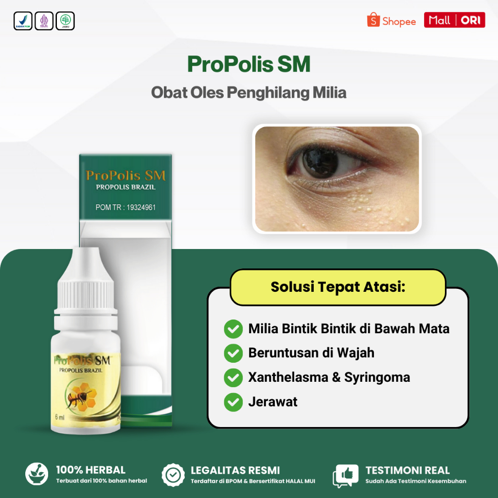 Propolis SM - Obat Oles Penghilang Milia, Milia di Bawah Mata, Milia di Kelopak Mata, Milia di Wajah
