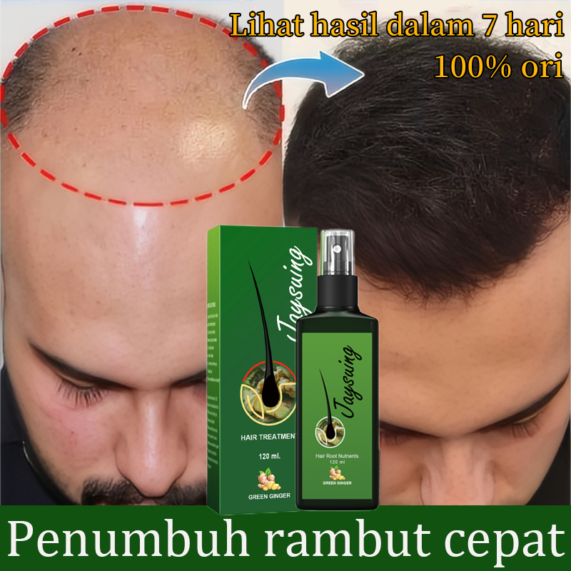 Serum penumbuh rambut hair tonic rambut rontok serum rambut rontok hair serum rambut rontok penumbuh