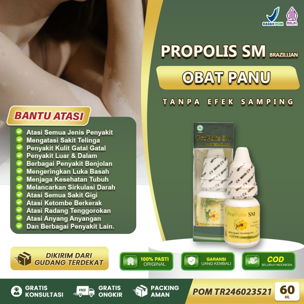 Obat Panu Di Wajah Bercak Putih Di Wajah Balas Bogo Kadas Jamur Kulit Obat Panu Anak dan Dewasa Lega