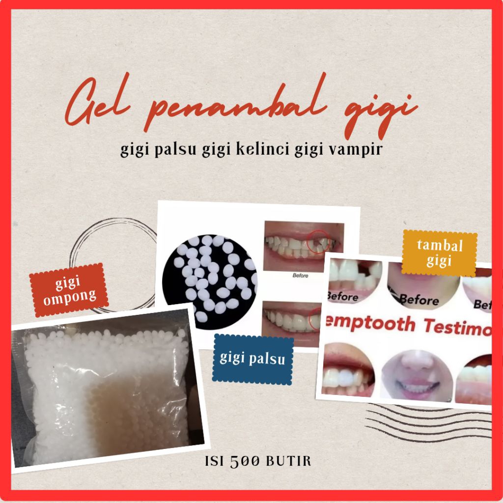 Penambal gigi 500 butir gel penambal gigi tambal gigi palsu gigi ompong gigi patah