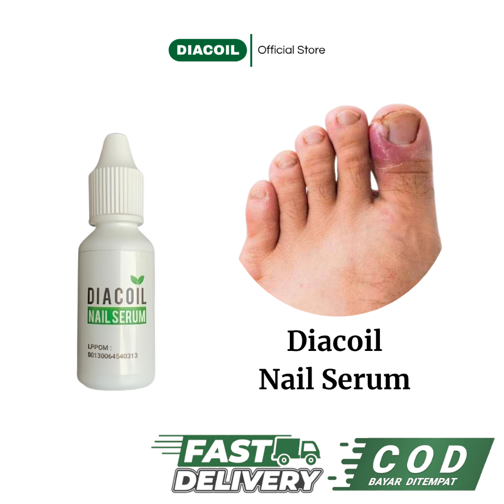 DIACOIL+ Nail serum Perawatan Jamur Kuku dan Kuku Cantengan, 20ml