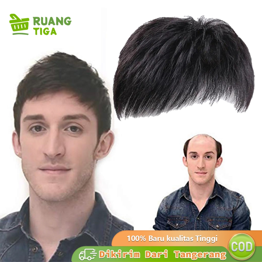 Penutup Botak Pria Rambut Palsu Pria Untuk Botak Toupee Botak Depan Pria Rambut Simulasi Pria