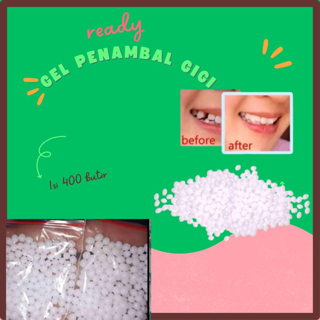 gel penambal gigi palsu gigi ompong gigi bolong gigi patah gigi kelinci isi 400butir