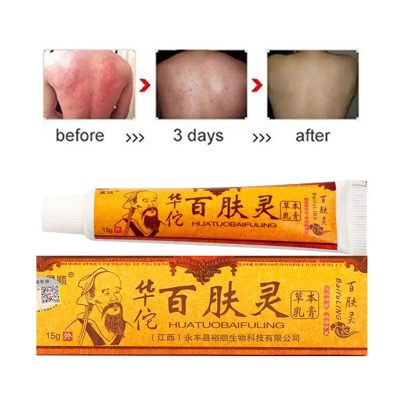 salep gatel  salep gatel kulit ampuh  salep kulit gatal ampuh  Salep Huatuobaifuling Cream Jamur Kur