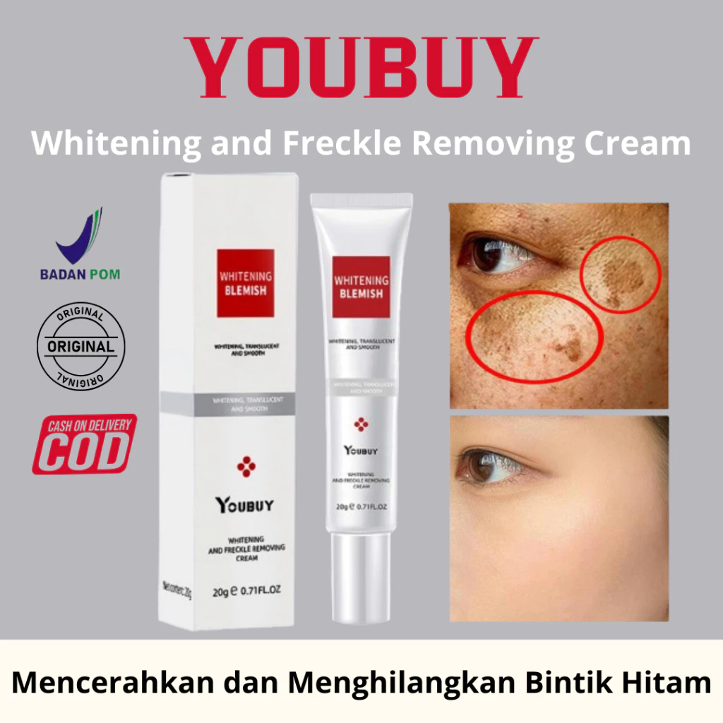 Youbuy Blemish Whitening Cream Whitening Freckle Cream Remove Dark Spots Anti Freckle Hitam Pelembab