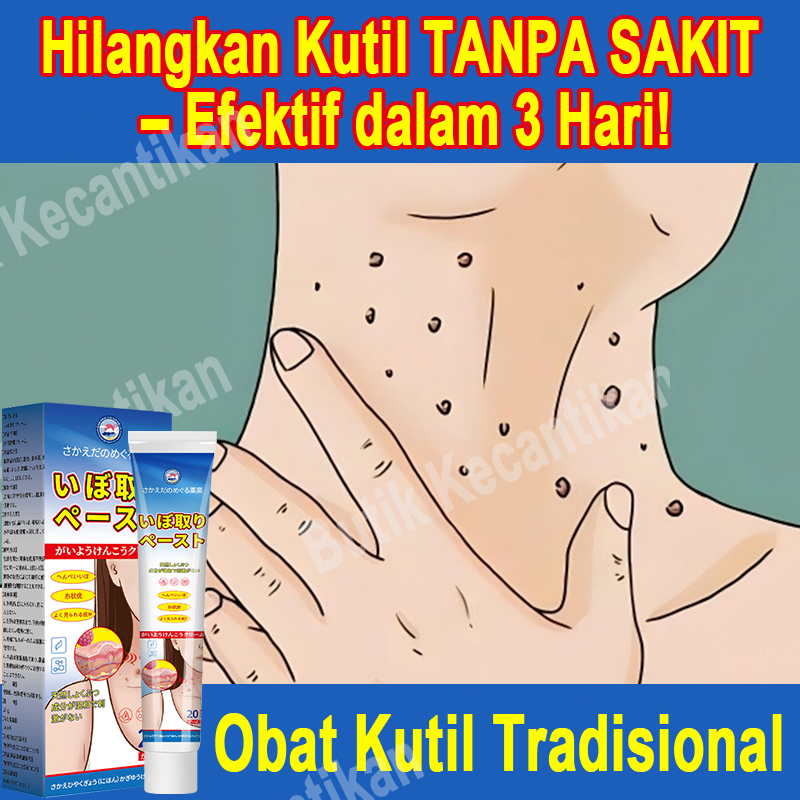 OBAT KUTIL ALAMI Ampuh untuk Kutil Kelamin (HPV), Kutil Biasa, Kutil Pipih & Kutil Kaki - HILANG TAN