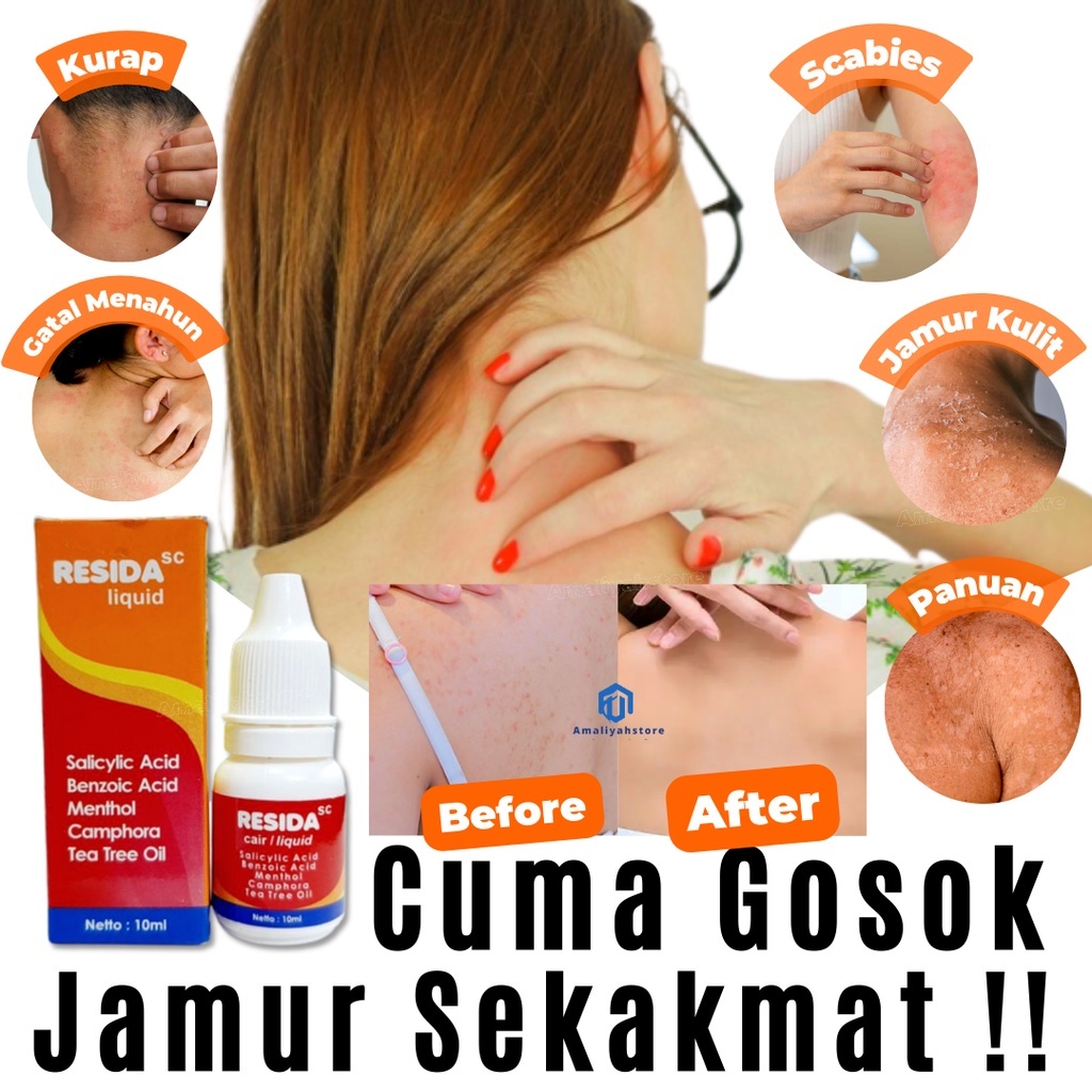 Resida cair seperti kalpanax cair 10 ml
