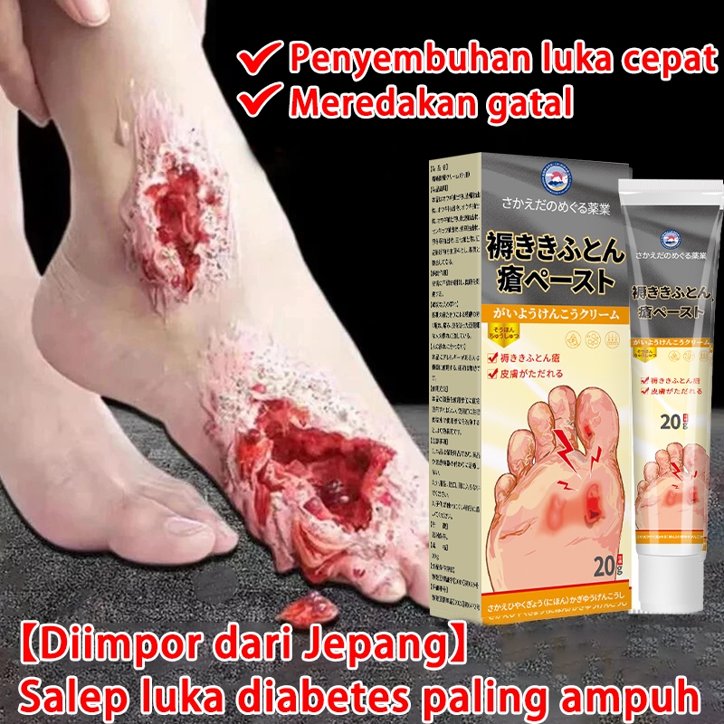 Krim Luka baring JepangSalep Krim Decubitus Mengobati  luka diabetes paling ampuh Salep luka baring 