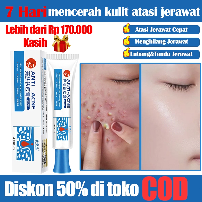 herbal acne cream jerawat efisien  penghilang jerawat menghilangkan bekas jerawat menghilangkan beka