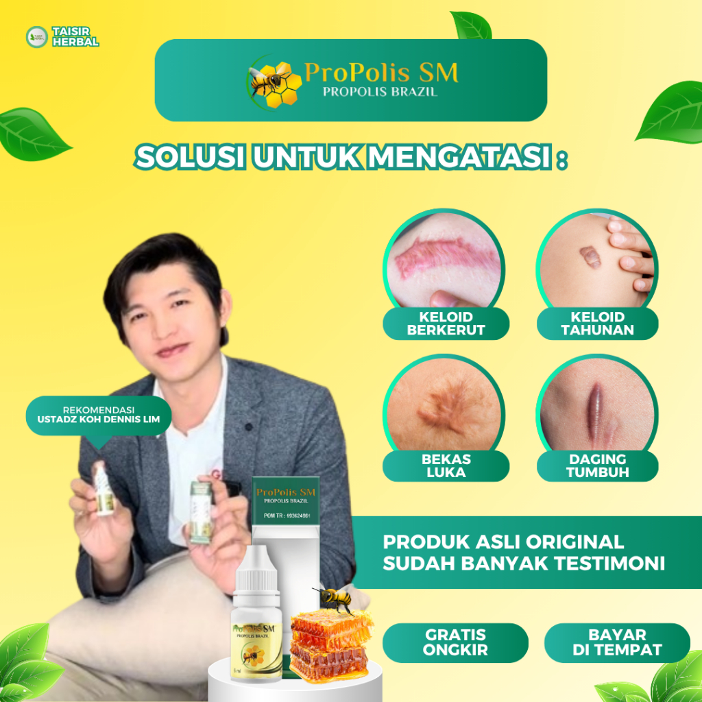 Propolis SM Penghilang Keloid, Daging Jadi, Keloid Berkerut, Pembersih Keloid, Bekas Tindik Tahunan,