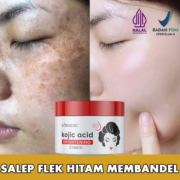 【BPOM】Krim penghilang flek hitam cream flek hitam membandel salep flek hitam membande
