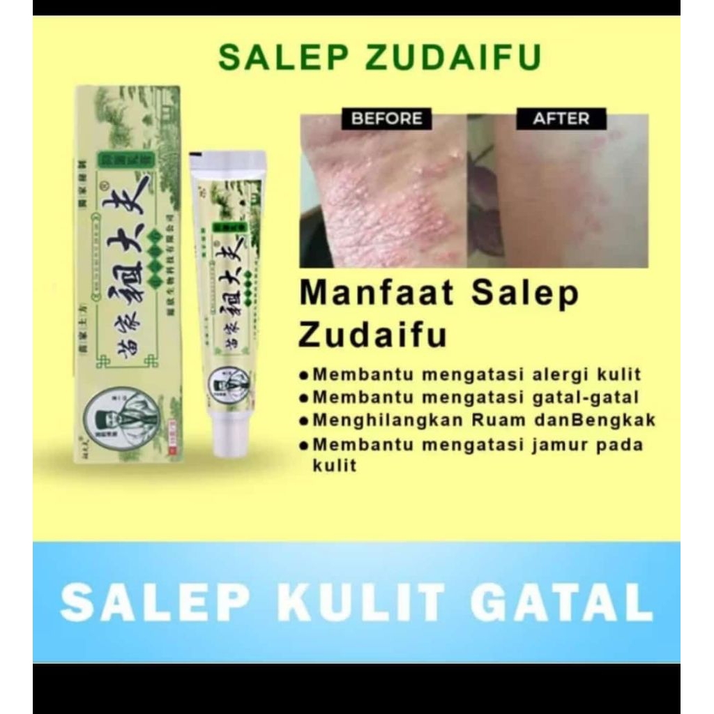 salap super ampuh untuk menghilangkan gatal
