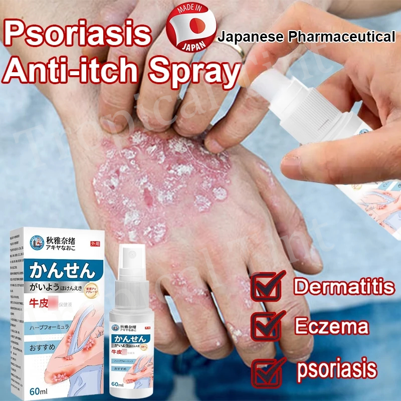 spray gatal selangkangan Salep gatal paling ampuh Obat psoriasis spray gatal salep gatal kulit yang 