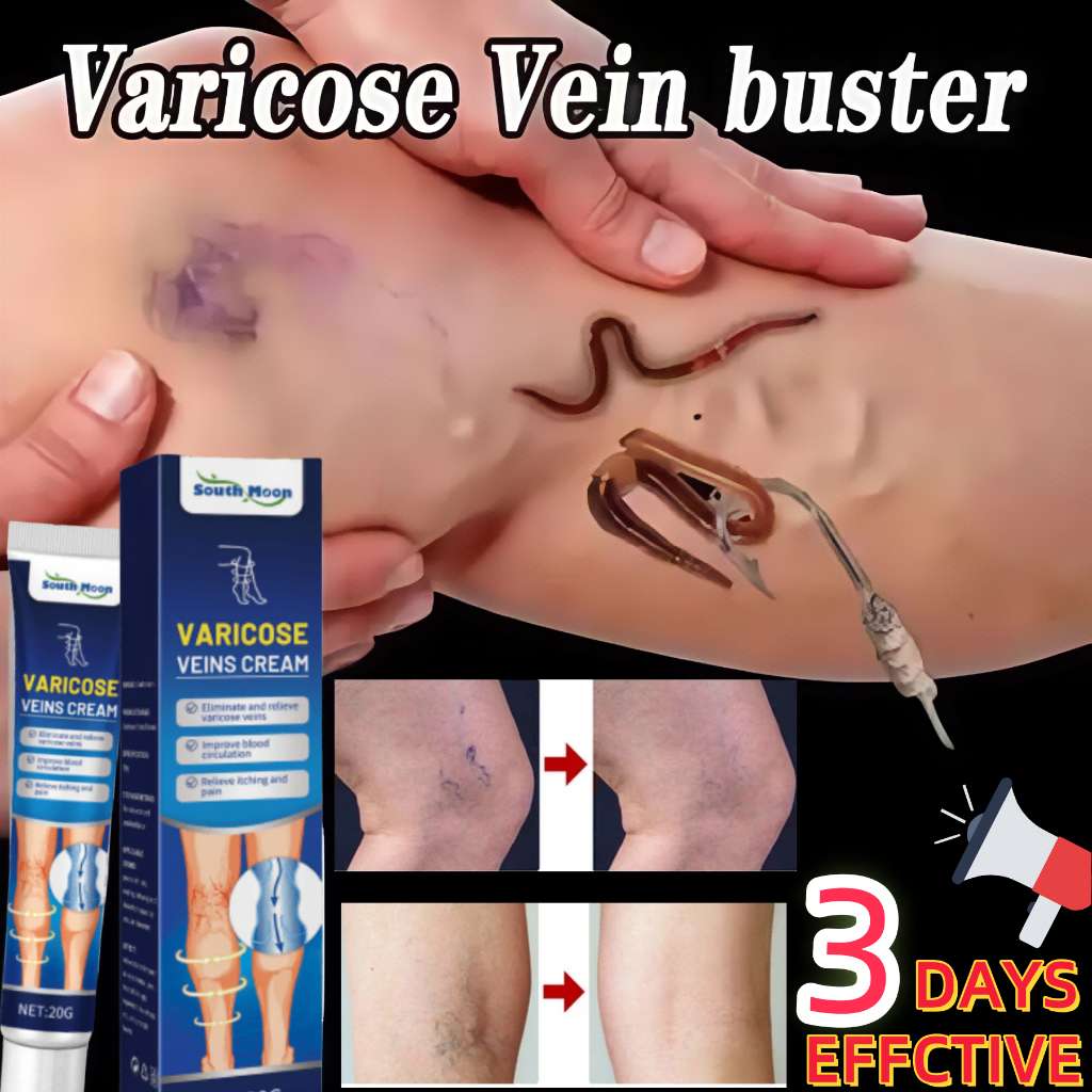 【20g】Cream Varises Paling Ampuh Original Salep Varises Obat Varises Salep Varises Salep Laba-Laba Va