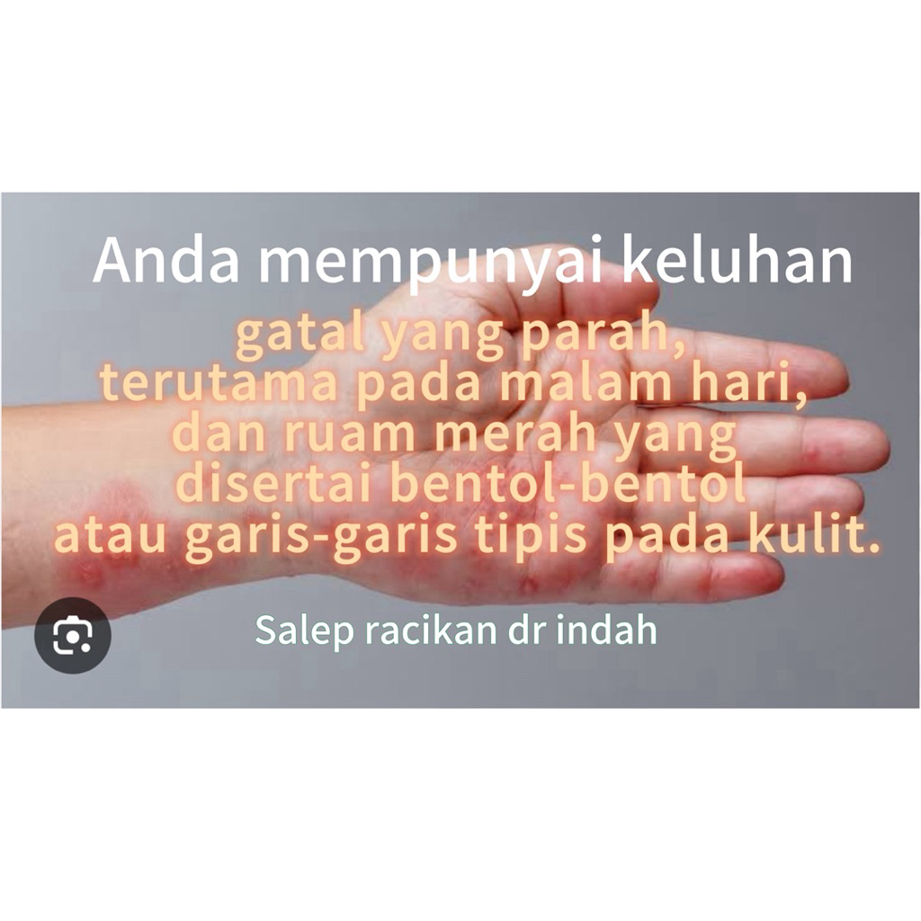 salep racikan dr indah (untuk skabies dan eksim isi 10 gr)