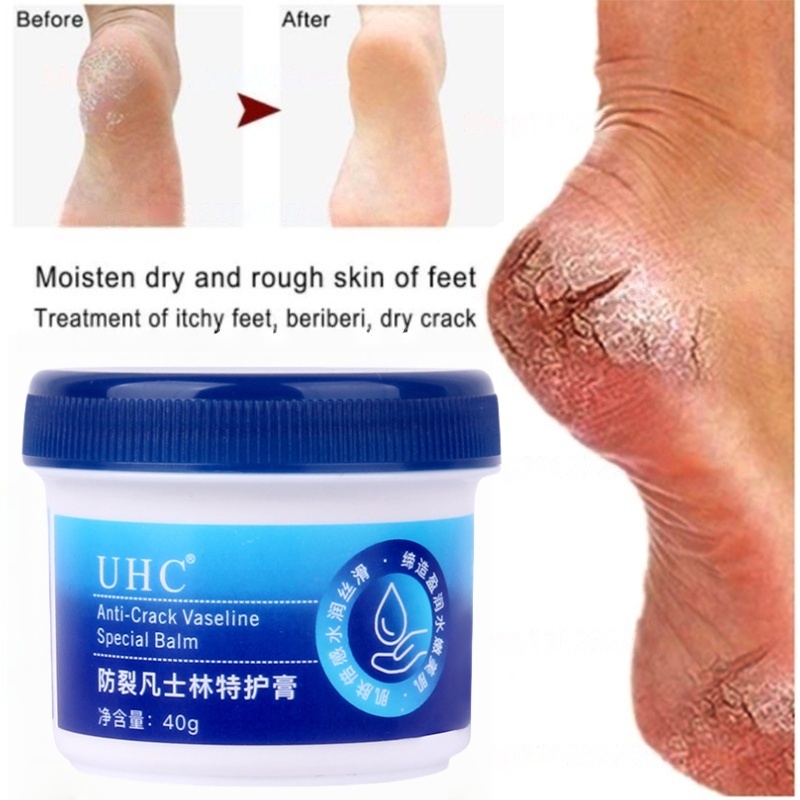 Vaseline kaki pecah dan kering Pelembab kaki kering dan pecah Vaseline anti kering kaki Krim Kaki Me
