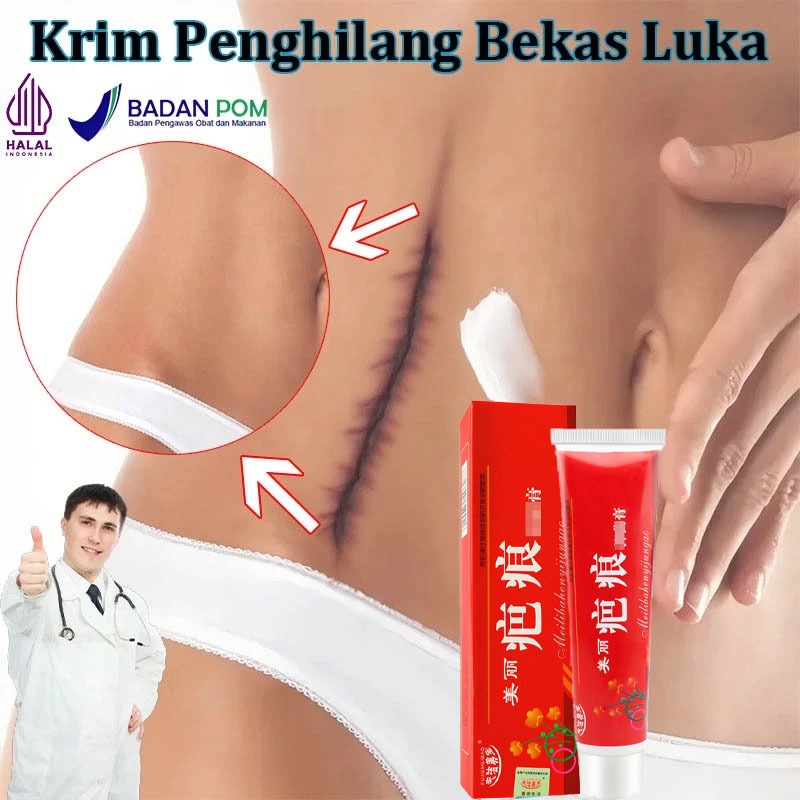 Salep Bekas Luka Hitam Penghilang Bekas Luka 60g Obat Penghilang Bekas Luka Penghilang Bekas Luka Be