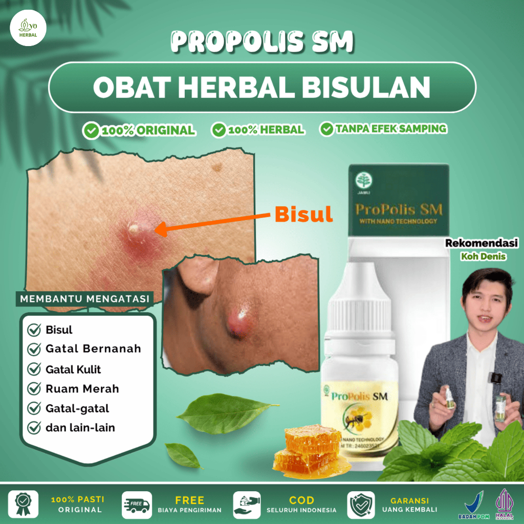 Propolis SM untuk Bisul di Pantat, Pengempes Bisul, Bisul Berdarah, Bisul di Kepala, Bisul di Wajah 