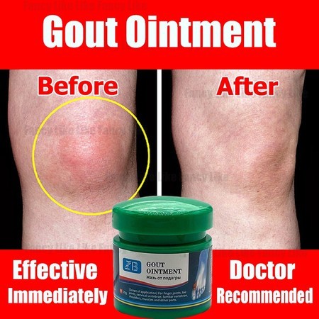 Salep asam urat, salep anti bengkak dan pereda nyeri, salep herbal asam urat