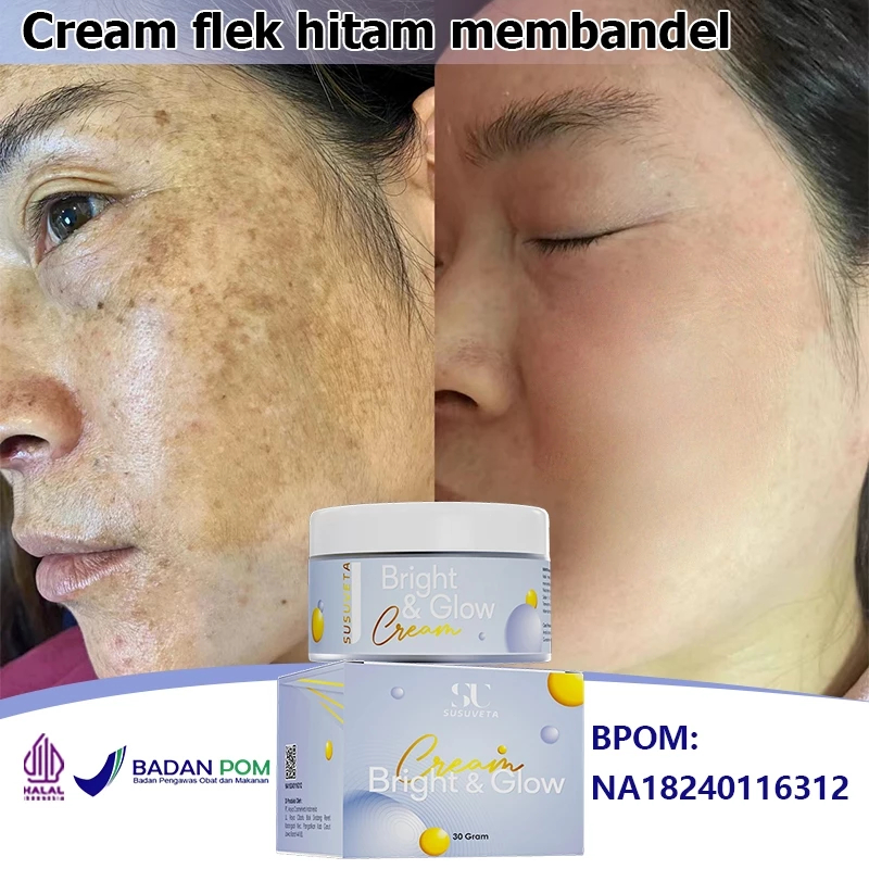 SUSUVETA Salep flek hitam membandel Cream penghilang flek hitam Cream flek hitam membandel 30g Salep