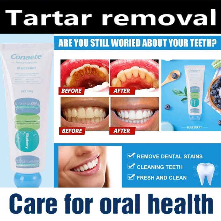Conaete  Pembersih Karang Gigi Toothpaste Whitening Rasa Dan Bluberry