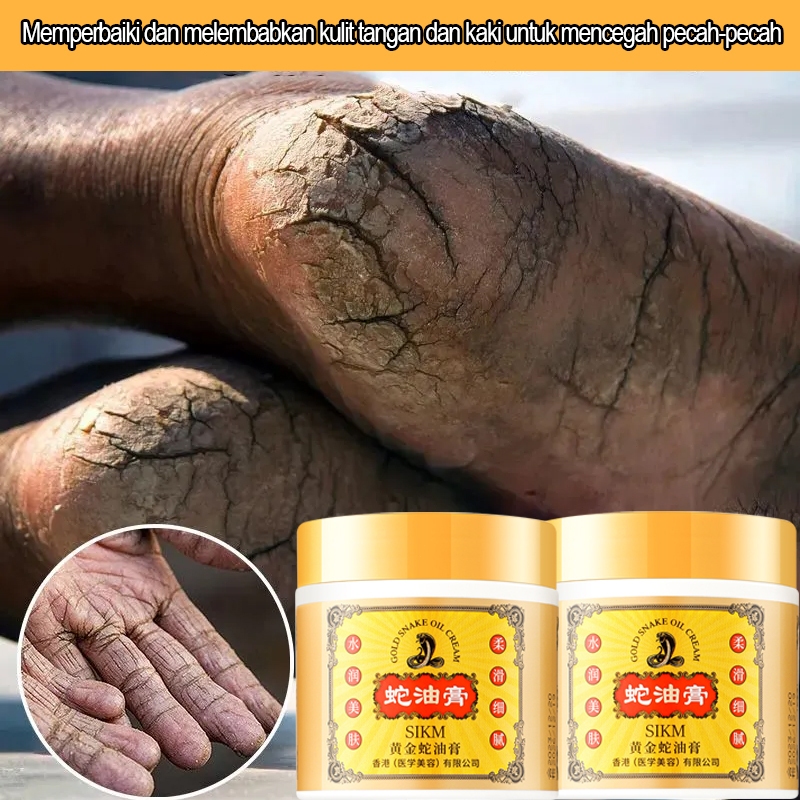 Obat kaki pecah-pecah Krim kaki pecah-pecah Krim perbaikan tangan dan kaki 120g Krim kaki Mengatasi 
