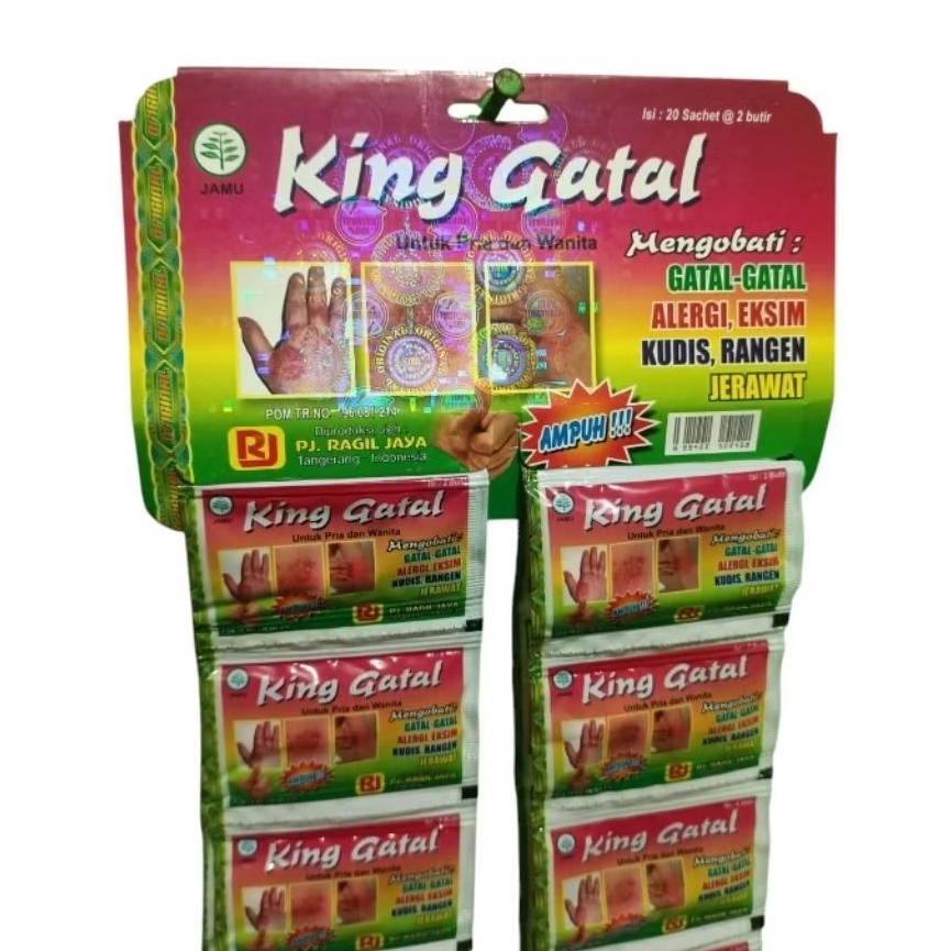 Gatal gatal king gatal alergi kadas kuraf jerawat anti jamur