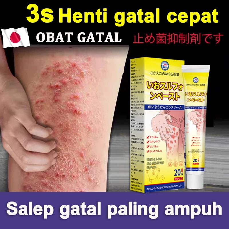 Salep Gatal Paling Ampuh Obat Gatal Selangkangan Obat Eksim Obat Kurap 20g Ampuh Obat Gatal Kulit Sa