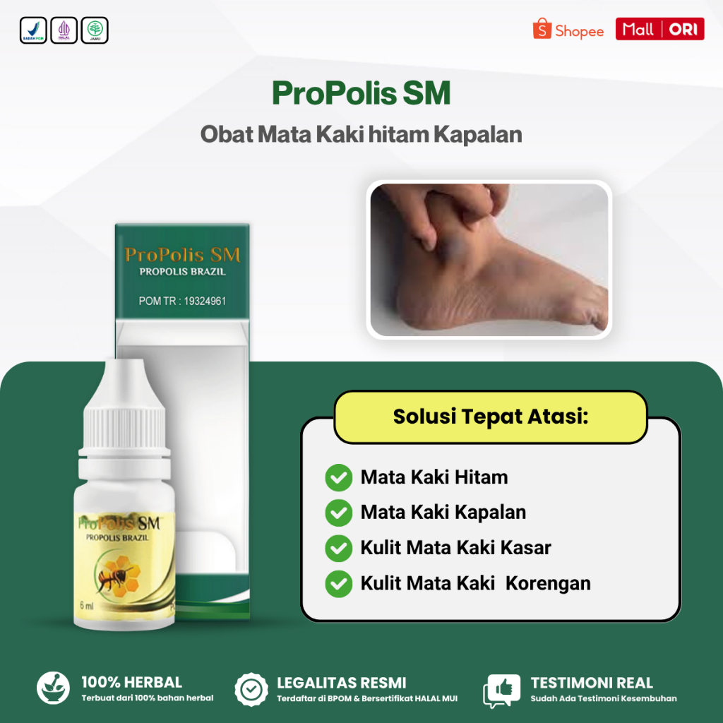 Obat Mata Kaki Hitam, Penghilang Hitam di Mata Kaki, Mata Kaki Kapalan, Kulit Mata Kaki Kasar Kering