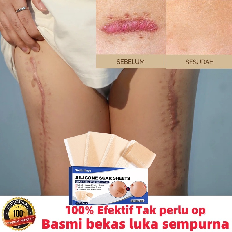 babyyassa - salep penghilang bekas luka hitam, koreng, jerawat & flek hitam - kaki & wajah