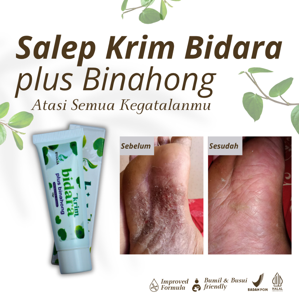 Salep Gatal - Salep Bidara plus Binahong Original