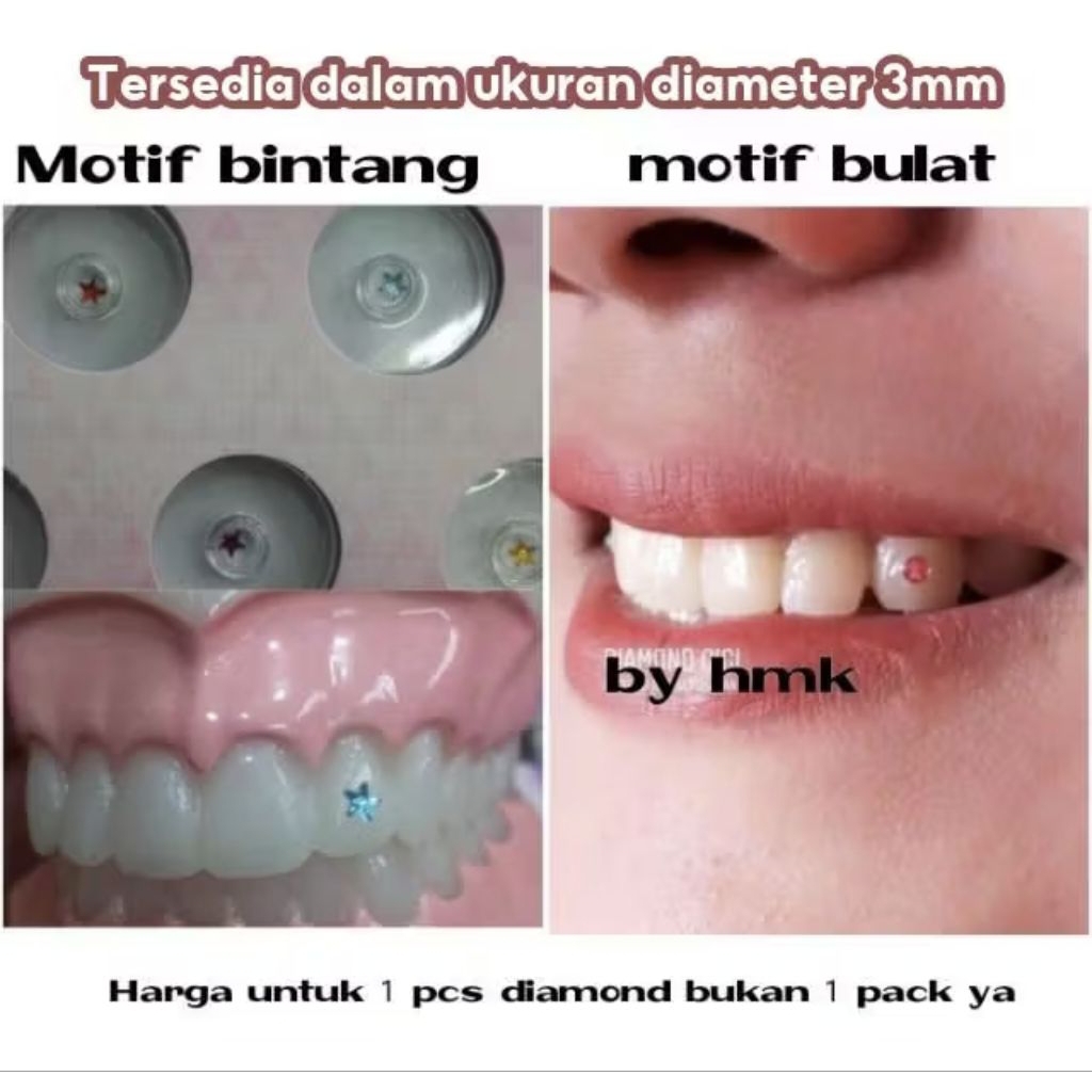 Diamond gigi permata gigi