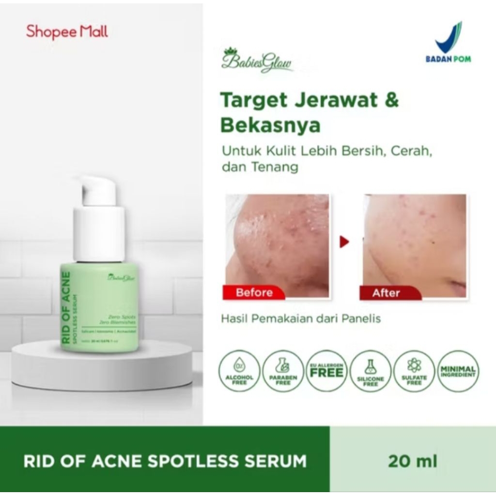 Babies Glow Rid of Acne Spotless Serum