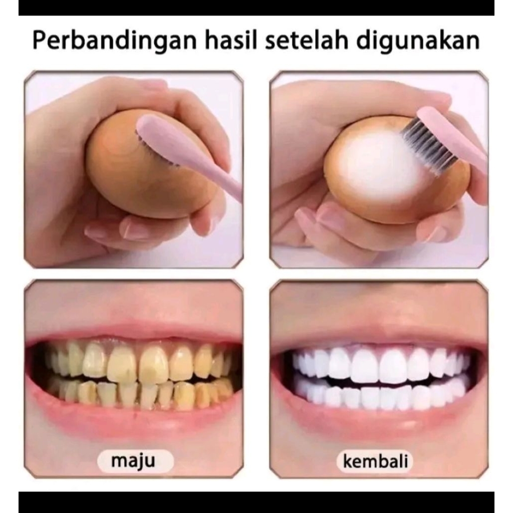 pasta gigi Arang memutihkan gigi kuning