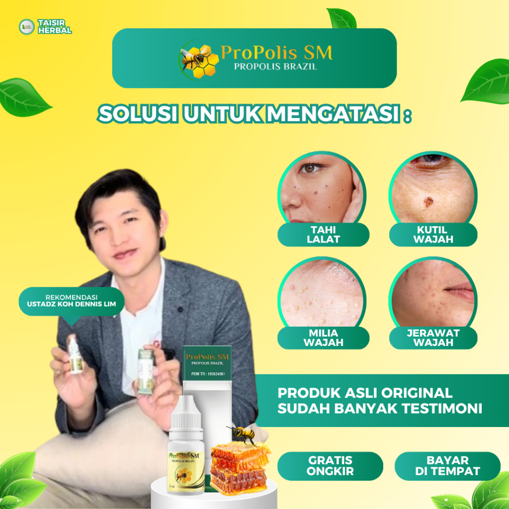 Propolis SM Cairan Perawatan Kutil dan Tahi Lalat Penghilang Kutil Di Wajah Leher Badan Area Tubuh U