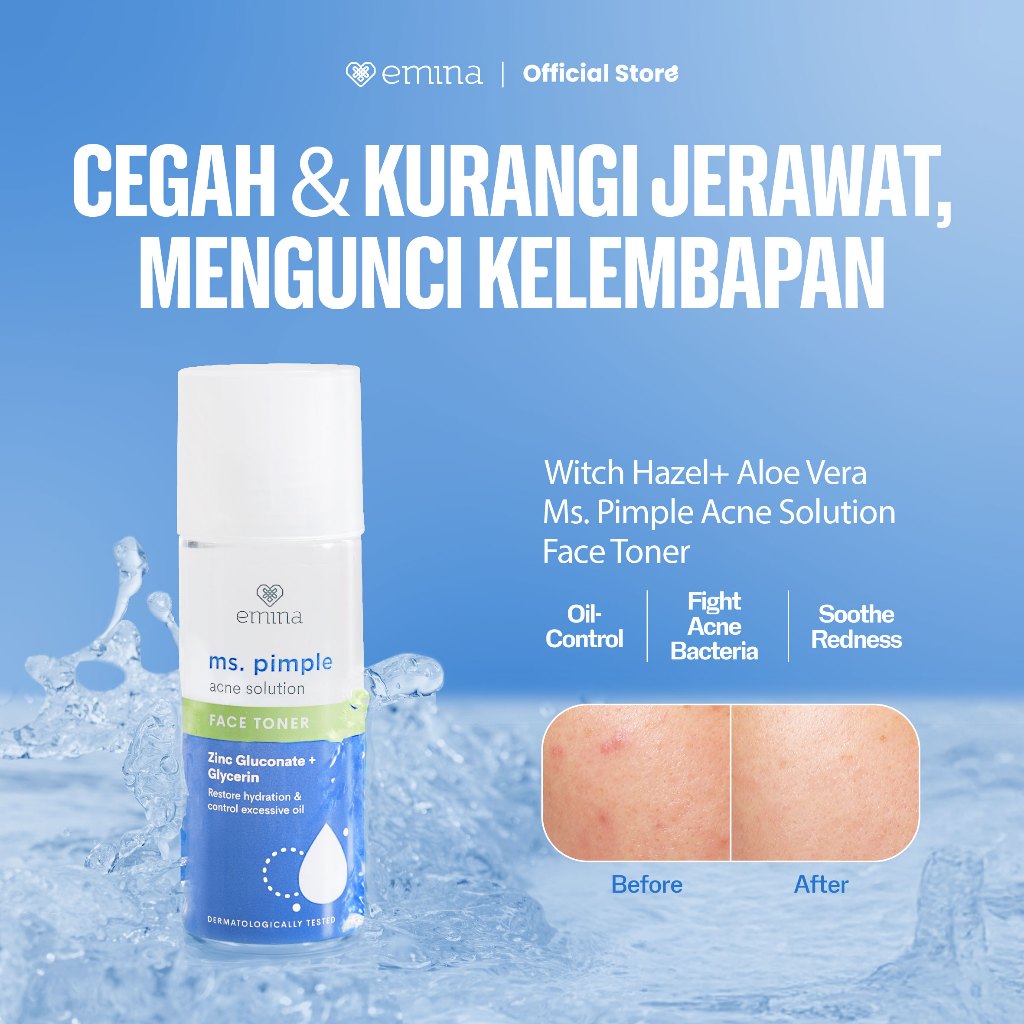 Emina Ms. Pimple Acne Solution Face Toner - Toner Wajah Melembabkan Kulit Berjerawat