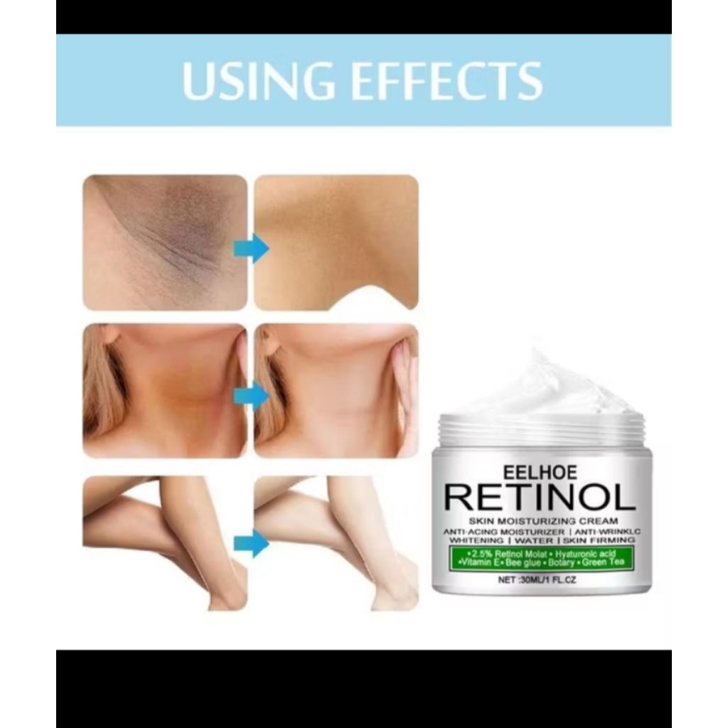 EELHOE RETINOL pemutih kulit tubuh, ketiak, selangkangan dll