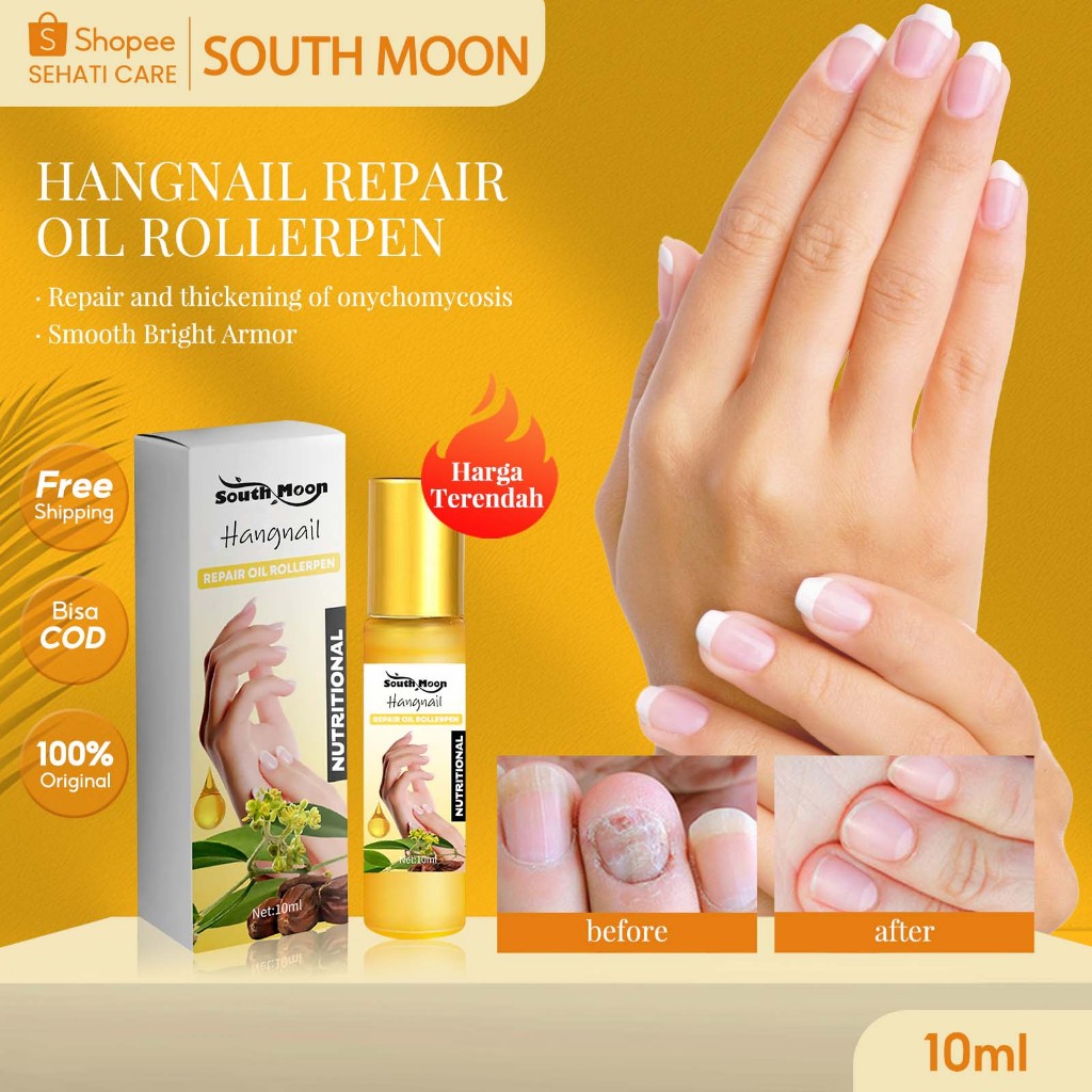 South Moon Hangnail Repair Oil Rollerpen 10ml Pena Rollerball Perbaikan Kuku Memperbaiki Onikomikosi