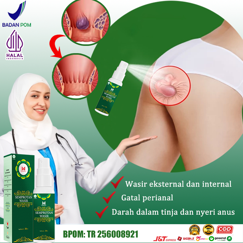 Ecliptor Salep ambeien paling ampuh Obat wasir Obat ambeien Salep wasir ampuh asli china 30ml salep 