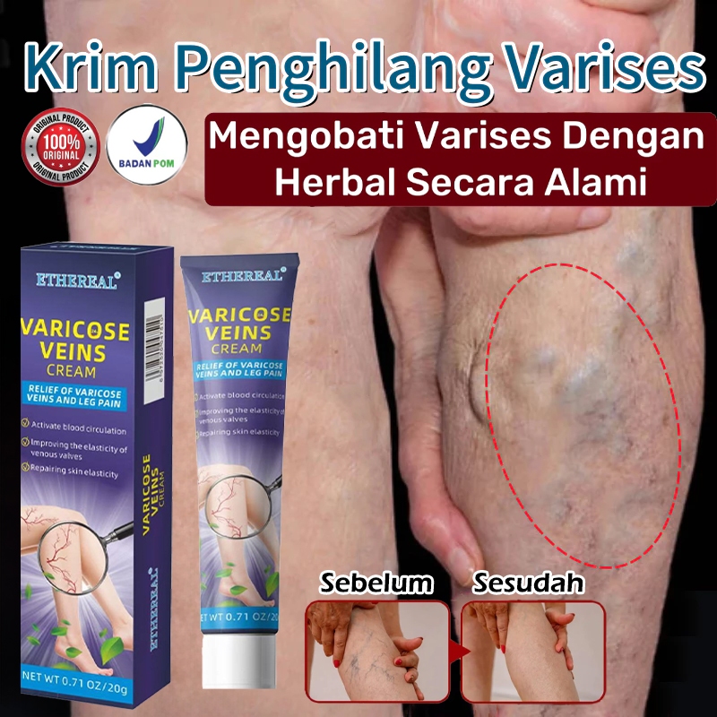 Obat varises salep varises cream varises paling ampuh original obat varises paling ampuh salep varis