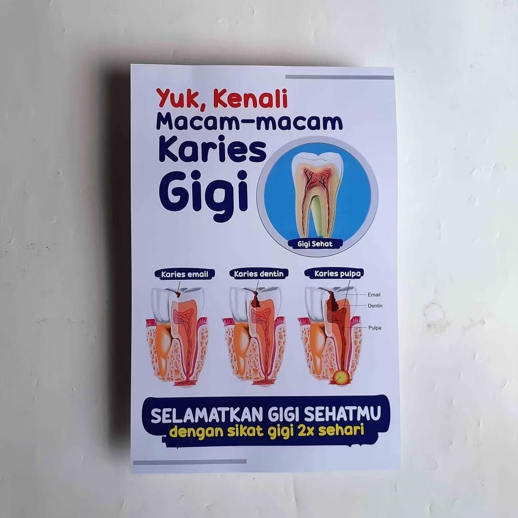 

Poster Kesehatan - Kenali Macam-macam Karies Gigi, Laminasi Glossy