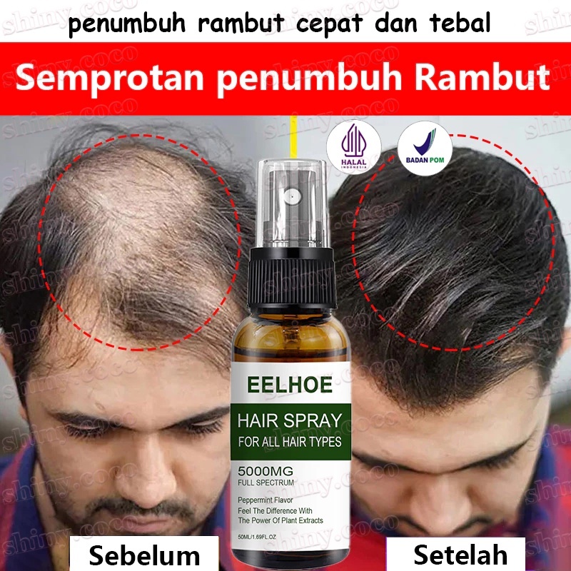 Serum Penumbuh Rambut Hair Growth Spray Penumbuh Rambut Botak Semprotan Penebal Rambut Penumbuh Ramb
