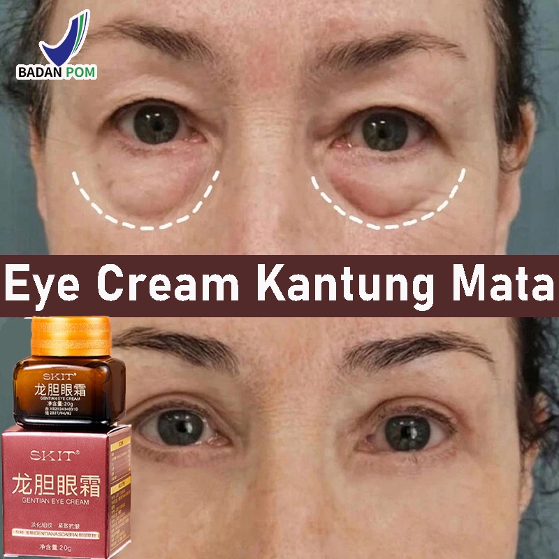 Eye Cream Kantung Mata Menghilangkan Mata Panda Penghilang Kantung Mata Krim Mata Memudar Lingkaran 