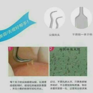 pinset komedo - alat pembersih komedo - blackhead remover