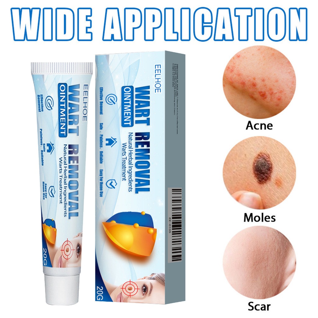 Pengiriman 24 jam 100% ORI Penghilang Kutil Dan Tahi Llat Wart Removal Cream Krim Penghilang Kutil D