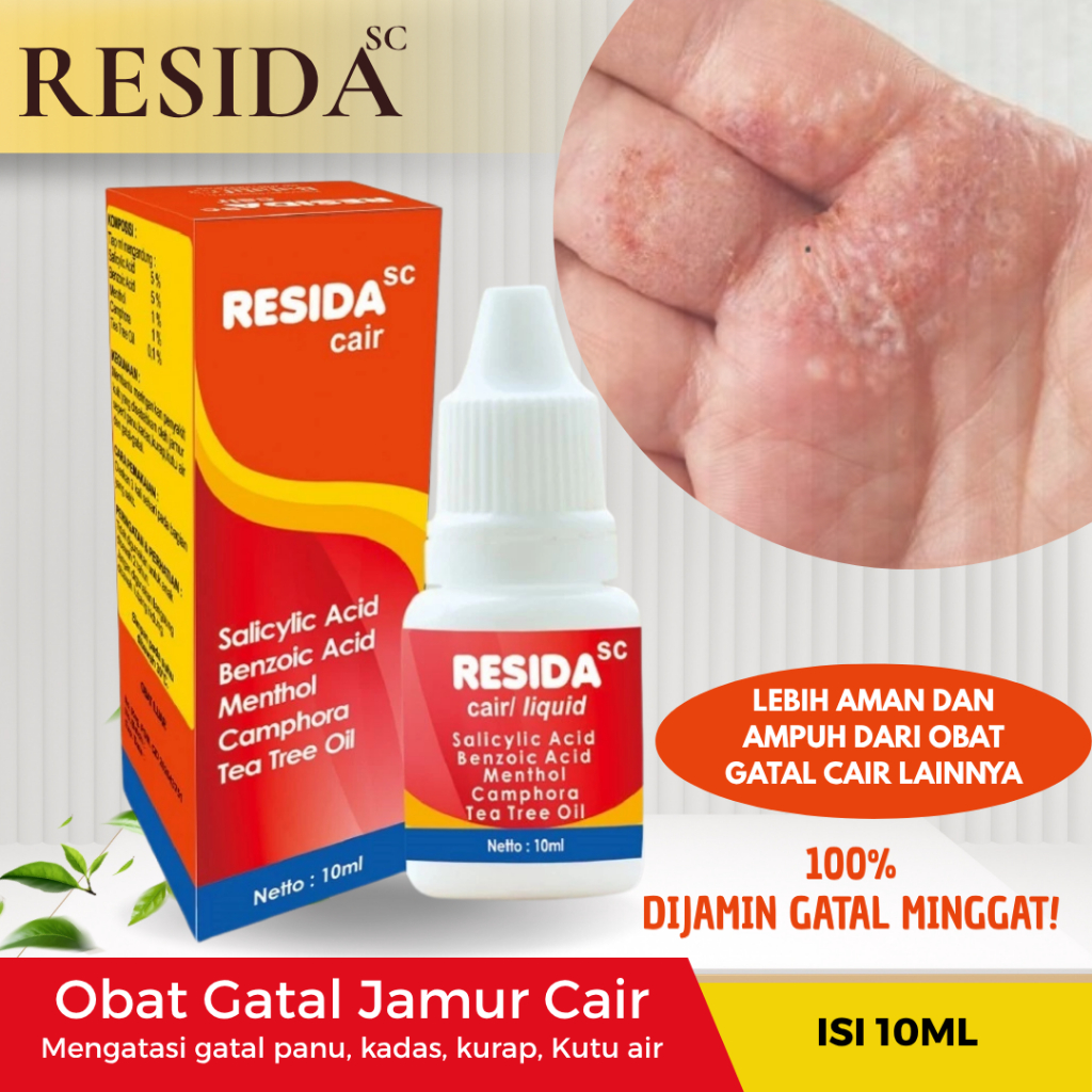 Obat Panu Paling Ampuh 100% Penghilang Jamur Kutu Air Kulit Badan Wajah Jerawat Hapur Kulit Cepat Hi
