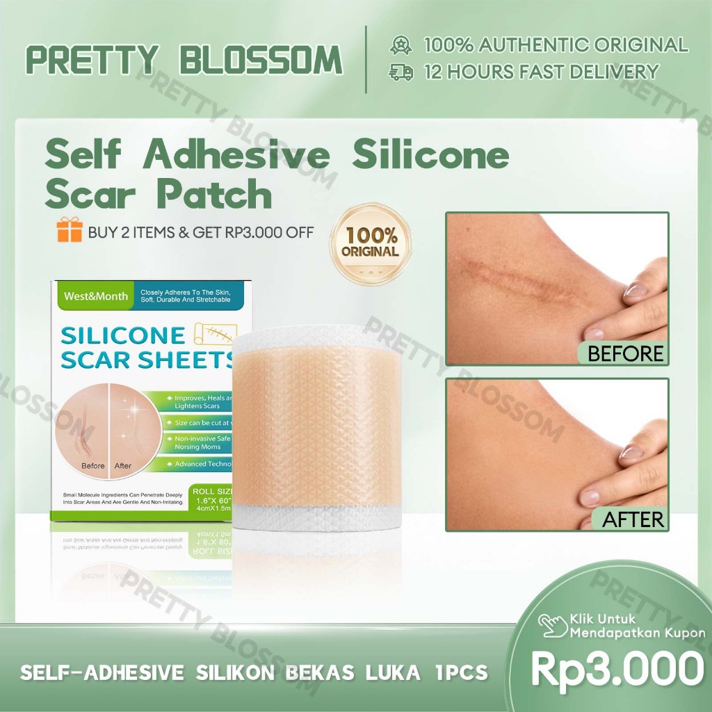 Scar Silicone Scar Sheet 1Roll 4*1.5m Plester Silikon Bekas Luka Dermaline Silicone Keloid 1Roll Kel