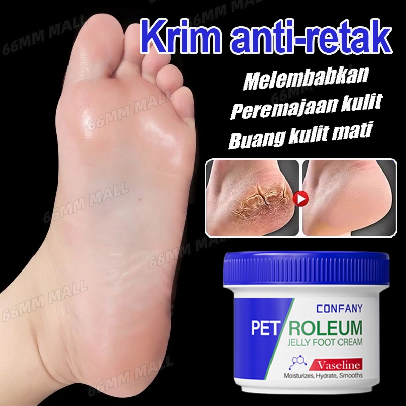 obat kaki pecah pecah Vaseline kaki pecah dan kering 50g salep kaki pecah2 paling ampuh obat tumit p